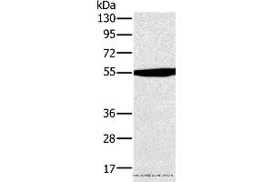 Western blot analysis of Hela cell , using OXCT1 Polyclonal Antibody at dilution of 1:300