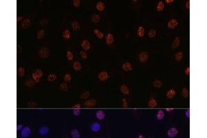 Immunofluorescence analysis of C6 cells using DiMethyl-Histone H3-K14 Polyclonal Antibody at dilution of 1:100 (40x lens).