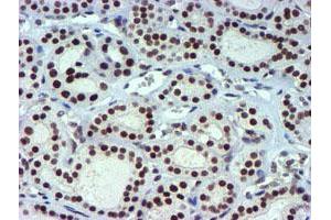 Image no. 13 for anti-Ubiquitin Specific Peptidase 7 (Herpes Virus-Associated) (USP7) antibody (ABIN1498592) (USP7 anticorps)