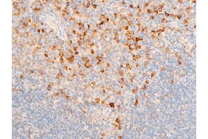 ABIN6267219 at 1/100 staining mouse spleen tissue sections by IHC-P. (NFKBIE anticorps  (pSer161))