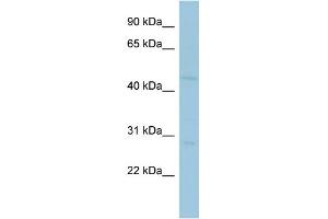 WB Suggested Anti-MAGEA10 Antibody Titration:  0. (MAGEA10 anticorps  (Middle Region))