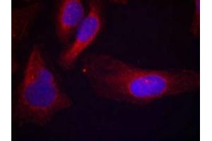 Immunofluorescence staining of methanol-fixed Hela cells using c-Cbl(phospho-Tyr700) Antibody.
