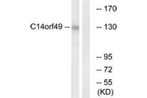 Western blot analysis of extracts from Jurkat cells, using C14orf49 Antibody.