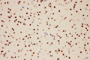 Anti-PIAS1 antibody, IHC(P) IHC(P): Rat Brain Tissue