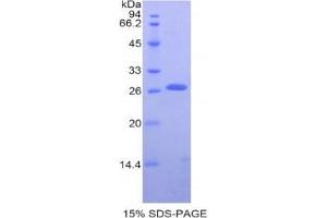 SDS-PAGE analysis of Human Transferrin Receptor Protein. (Transferrin Receptor Protéine)