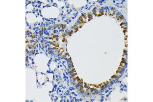 Immunohistochemistry of paraffin-embedded mouse lung using IQG antibody (ABIN7268020) at dilution of 1:200 (40x lens). (IQGAP1 anticorps  (AA 500-750))