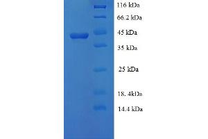 p46 (AA 28-416) protein (His tag)