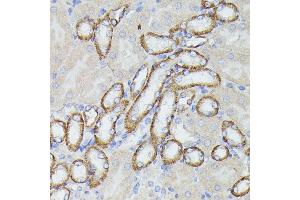 Immunohistochemistry of paraffin-embedded mouse kidney using LTF antibody (ABIN6131498, ABIN6143382, ABIN6143383 and ABIN6216705) at dilution of 1:100 (40x lens).