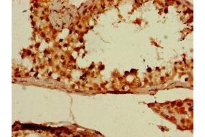 Immunohistochemistry of paraffin-embedded human testis tissue using ABIN7149640 at dilution of 1:100 (DAZL anticorps  (AA 130-250))