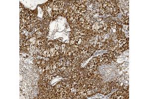 IHC analysis of MTTP using anti-MTTP antibody (ABIN7601145). (MTTP anticorps  (AA 29-702))