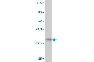 Western Blot detection against Immunogen (35.