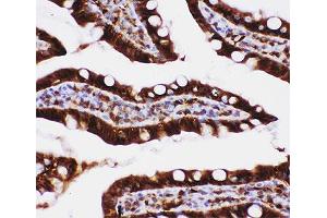 IHC-P: Caspase-3 antibody testing of rat intestine tissue