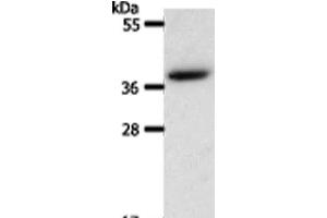 Western Blot analysis of Hela cell using AKR1B1 Polyclonal Antibody at dilution of 1:550 (AKR1B1 anticorps)