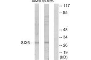 Western blot analysis of extracts from HuvEc/COLO205 cells, using SIX6 Antibody. (SIX Homeobox 6 anticorps  (AA 121-170))