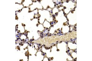 Immunohistochemistry of paraffin-embedded mouse lung using WHSC1 antibody (ABIN6128925, ABIN6150213, ABIN6150214 and ABIN6223939) at dilution of 1:100 (40x lens). (WHSC1 anticorps  (AA 1-240))
