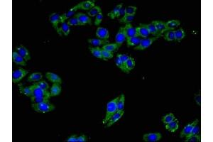 anti-ADP-Ribosyltransferase 3 (ART3) (AA 279-352) antibody