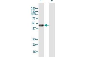Western Blot analysis of PHKG2 expression in transfected 293T cell line by PHKG2 MaxPab polyclonal antibody. (PHKG2 anticorps  (AA 1-406))