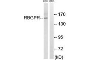 Western blot analysis of extracts from COS cells, using RAB3GAP2 Antibody. (RAB3GAP2 anticorps  (AA 417-466))