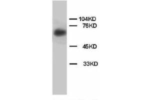 Image no. 2 for anti-Lamin B (AA 570-586) antibody (ABIN1493471) (Lamin B anticorps  (AA 570-586))