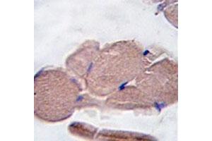IHC analysis of FFPE human skeletal muscle tissue stained with Myostatin antibody