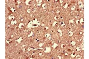 Immunohistochemistry of paraffin-embedded human brain tissue using ABIN7164558 at dilution of 1:100 (LMBRD1 anticorps  (AA 6-100))