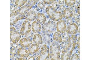 Immunohistochemistry of paraffin-embedded Mouse kidney using AP2A1 Polyclonal Antibody at dilution of 1:100 (40x lens). (alpha Adaptin anticorps)
