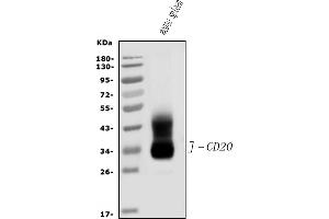 Western blot analysis of CD20/MS4A1 using anti-CD20/MS4A1 antibody (ABIN7599223). (CD20 anticorps  (AA 1-291))