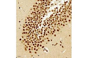 Immunohistochemistry of paraffin embedded rat brain using rap1 (ABIN7075857) at dilution of 1: 2000 (400x lens)