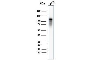 Western Blot Analysis of PC3 cell lysate using Drebrin-1 Mouse Monoclonal Antibody (DBN1/2879).