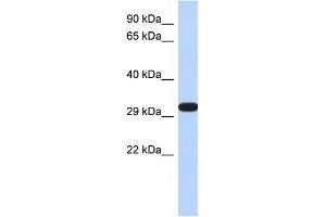 DDAH2 antibody used at 1 ug/ml to detect target protein.