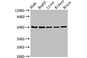 Western Blot Positive WB detected in: A549 whole cell lysate, HepG2 whole cell lysate, Mouse liver tissue, Mouse kidney tissue, Mouse brain tissue All lanes: SLC33A1 antibody at 2. (SLC33A1 anticorps  (AA 1-74))