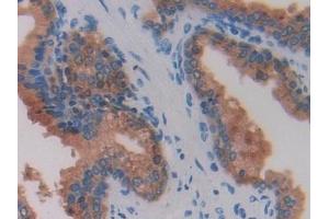 Detection of BRCA1 in Human Prostate Tissue using Polyclonal Antibody to Breast Cancer Susceptibility Protein 1 (BRCA1)