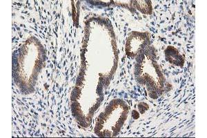 Image no. 7 for anti-Catalase (CAT) antibody (ABIN1497109)