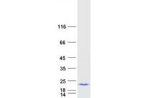 Validation with Western Blot