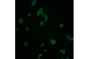 Immunofluorescence staining of PC-3 cells with ABIN7154884 at 1:100, counter-stained with DAPI.