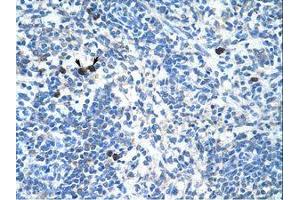 anti-Transcription Factor MafB (MAFB) (AA 41-90) antibody