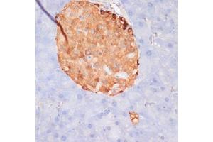Immunohistochemistry of paraffin-embedded mouse pancreas using Phospho-ACLY-S455 antibody (ABIN6135178, ABIN6136002, ABIN6136003 and ABIN6225678) at dilution of 1:100 (40x lens).