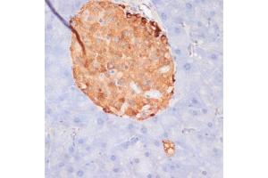 Immunohistochemistry of paraffin-embedded mouse pancreas using Phospho-ACLY-S455 antibody (ABIN6135178, ABIN6136002, ABIN6136003 and ABIN6225678) at dilution of 1:100 (40x lens).