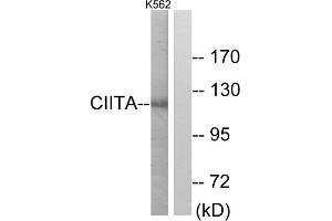 Western blot analysis of extracts from K562 cells, using CIITA antibody.