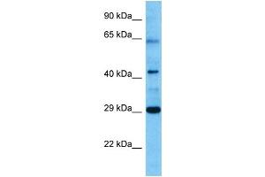 Host:  Mouse  Target Name:  VDR  Sample Tissue:  Mouse Pancreas  Antibody Dilution:  1ug/ml (Vitamin D Receptor anticorps  (N-Term))