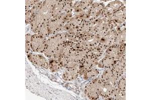 Immunohistochemical staining of human stomach with APIP polyclonal antibody  shows strong nuclear positivity in glandular cells. (APIP anticorps)