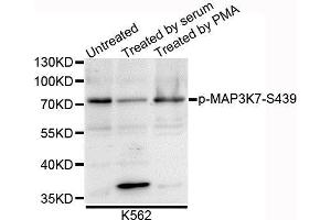 Western blot analysis of extracts of K562 cells, using Phospho-MAP3K7-S439 antibody.