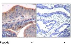 Image no. 1 for anti-Stathmin 1 (STMN1) (Ser62) antibody (ABIN319391)
