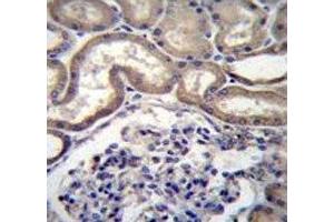 STIM2 antibody immunohistochemistry analysis in formalin fixed and paraffin embedded human kidney tissue.
