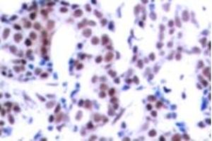 Image no. 2 for anti-Jun B Proto-Oncogene (JUNB) (pSer259) antibody (ABIN318057) (JunB anticorps  (pSer259))
