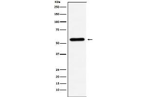 Western blot analysis of Liver Carboxylesterase 1 expression in U937 cell lysate.