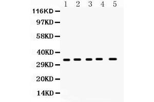 Western blot analysis of CCS expression in rat brain extract ( Lane 1), rat spleen extract ( Lane 2), mouse brain extract ( Lane 3), mouse spleen extract ( Lane 4) and 293T whole cell lysates ( Lane 5).