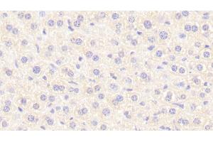 Detection of NT in Mouse Liver Tissue using Polyclonal Antibody to Neurotensin (NT) (Neurotensin anticorps  (AA 42-167))