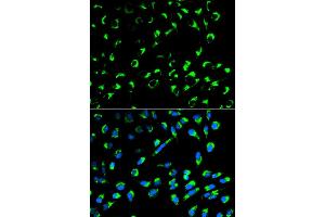 Immunofluorescence analysis of MCF-7 cells using SFN antibody. (14-3-3 sigma/SFN anticorps)