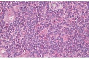 Image no. 1 for anti-Inducible T-Cell Co-Stimulator Ligand (ICOSLG) (AA 197-246) antibody (ABIN6749802)